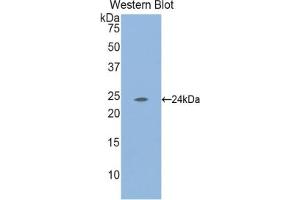 Detection of Recombinant LAMa2, Mouse using Polyclonal Antibody to Laminin Alpha 2 (LAMa2) (Laminin Antikörper  (AA 2901-3106))