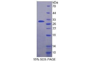 SDS-PAGE (SDS) image for Casein alpha S1 (CSN1S1) (AA 16-187) protein (His tag) (ABIN6237589) (Casein alpha S1 Protein (CSN1S1) (AA 16-187) (His tag))