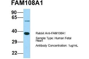 Host: Rabbit  Target Name: FAM108A1  Sample Tissue: Human Fetal Heart  Antibody Dilution: 1. (ABHD17A Antikörper  (C-Term))