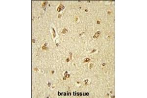 Immunohistochemistry (Paraffin-embedded Sections) (IHC (p)) image for anti-General Transcription Factor III (GTF2I) (AA 956-985), (C-Term) antibody (ABIN390868)