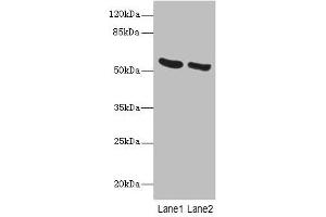 Western blot All lanes: PNPLA2 antibody at 10 μg/mL Lane 1: Mouse liver tissue Lane 2: NIH/3T3 whole cell lysate Secondary Goat polyclonal to rabbit IgG at 1/10000 dilution Predicted band size: 56, 20 kDa Observed band size: 56 kDa (PNPLA2 Antikörper  (AA 1-504))