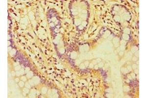 Immunohistochemistry of paraffin-embedded human small intestine tissue using ABIN7146954 at dilution of 1:100