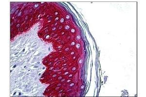 Human Skin: Formalin-Fixed, Paraffin-Embedded (FFPE) (KRT14 Antikörper  (C-Term))