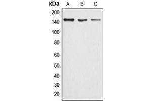 Western blot analysis of ARID4B expression in HeLa (A), MCF7 (B), rat lung (C) whole cell lysates.