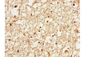 IHC image of ABIN7142087 diluted at 1:1000 and staining in paraffin-embedded human brain tissue performed on a Leica BondTM system. (YWHAE Antikörper  (AA 1-255))