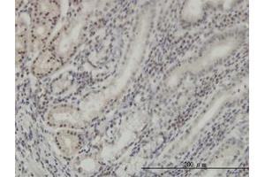 Image no. 1 for anti-Distal-Less Homeobox Protein 2 (DLX2) (AA 1-110) antibody (ABIN598648) (DLX2 Antikörper  (AA 1-110))