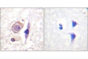 Immunohistochemistry analysis of paraffin-embedded human brain tissue, using Interferon-gamma Receptor alpha chain (Ab-457) Antibody. (IFNGR1 Antikörper  (AA 431-480))