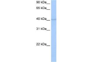 WB Suggested Anti-RBM4 Antibody Titration:  0. (RBM4 Antikörper  (C-Term))