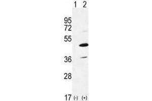 Western Blotting (WB) image for anti-Interleukin-1 Receptor-Associated Kinase 4 (IRAK4) (AA 5-36) antibody (ABIN3031498)