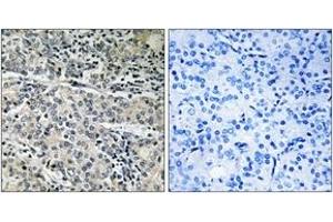 Immunohistochemistry analysis of paraffin-embedded human prostate carcinoma tissue, using MP68 Antibody. (C14orf2 Antikörper  (AA 9-58))
