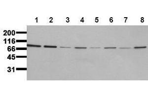 Western Blotting (WB) image for anti-Insulin Receptor (INSR) (Beta Chain) antibody (ABIN126821) (Insulin Receptor Antikörper  (Beta Chain))