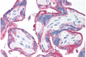 Human Placenta (formalin-fixed, paraffin-embedded) stained with CD59 antibody ABIN214204 at 20 ug/ml followed by biotinylated anti-mouse IgG secondary antibody ABIN481714, alkaline phosphatase-streptavidin and chromogen. (CD59 Antikörper)
