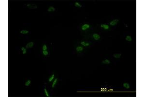 Immunofluorescence of monoclonal antibody to CCNL1 on HeLa cell.