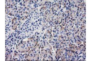 Immunohistochemistry (IHC) image for anti-Beclin 1, Autophagy Related (BECN1) antibody (ABIN1496865) (Beclin 1 Antikörper)