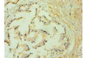 Immunohistochemistry of paraffin-embedded human prostate tissue using ABIN7157843 at dilution of 1:100 (GLO1 Antikörper  (AA 1-184))