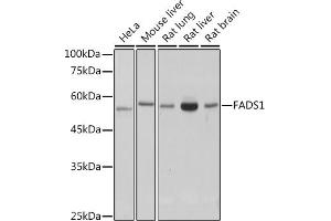 Western blot analysis of extracts of various cell lines, using F antibody (ABIN7267155) at 1:1000 dilution. (FADS1 Antikörper)