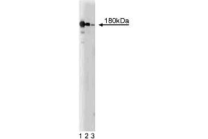 Western blot analysis of NMDAR2B on a rat cerebrum lysate. (GRIN2B Antikörper  (AA 892-1051))