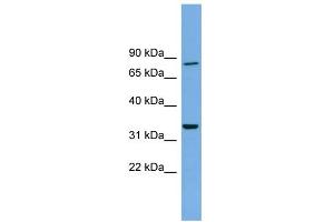 WB Suggested Anti-DDHD2 Antibody Titration: 0. (DDHD2 Antikörper  (N-Term))