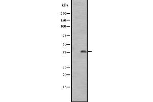 Western blot analysis of GPR1 expression in A431 whole cell lysate ,The lane on the left is treated with the antigen-specific peptide. (G Protein-Coupled Receptor 1 Antikörper  (C-Term))