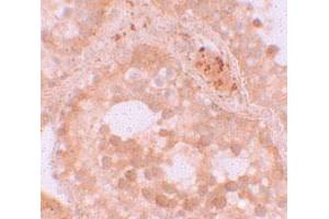 Immunohistochemical staining of human testis cells with WDR92 polyclonal antibody  at 10 ug/mL. (WDR92 Antikörper  (Internal Region))