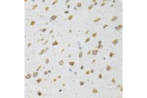 Immunohistochemistry of paraffin-embedded mouse brain using SIRT3 antibody (ABIN5973348) at dilution of 1/100 (40x lens).