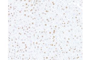 Immunohistochemistry (IHC) image for anti-SWI/SNF Related, Matrix Associated, Actin Dependent Regulator of Chromatin, Subfamily E, Member 1 (SMARCE1) (C-Term) antibody (ABIN7795730)