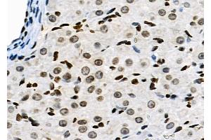 ABIN6263641 and ABIN6278983 at 1/100 staining Rat ovarian tissue by IHC-P. (NKAP Antikörper  (N-Term))