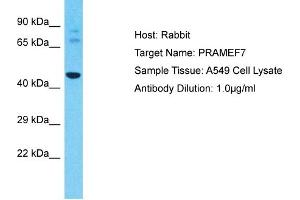 Host: Rabbit Target Name: PRAMEF7 Sample Type: A549 Whole Cell lysates Antibody Dilution: 1. (PRAMEF7 Antikörper  (N-Term))