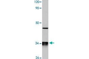Western blot analysis of HeLa cell lysate with CYB5R3 polyclonal antibody  at 1:500 dilution. (CYB5R3 Antikörper)