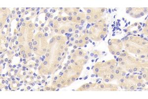 Detection of CEACAM1 in Mouse Kidney Tissue using Polyclonal Antibody to Carcinoembryonic Antigen Related Cell Adhesion Molecule 1 (CEACAM1) (CEACAM1 Antikörper  (AA 35-143))