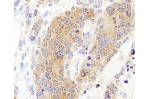 Immunohistochemistry (IHC) image for anti-Chaperonin Containing TCP1, Subunit 3 (Gamma) (CCT3) (AA 300-350) antibody (ABIN7453614) (CCT3 Antikörper  (AA 300-350))