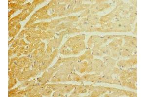 Immunohistochemistry of paraffin-embedded human heart tissue using ABIN7169925 at dilution of 1:100 (SCN7A Antikörper  (AA 265-368))