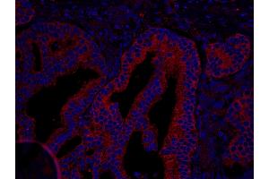 Immunofluorescence (IF) image for anti-Coronin, Actin Binding Protein, 1B (CORO1B) (AA 450-489) antibody (ABIN7448943)
