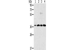 Gel: 12 % SDS-PAGE, Lysate: 40 μg, Lane 1-4: Hela cells, Jurkat cells, 293T cells, 231 cells, Primary antibody: ABIN7193012(VEGFA Antibody) at dilution 1/300, Secondary antibody: Goat anti rabbit IgG at 1/8000 dilution, Exposure time: 50 seconds (VEGFA Antikörper)