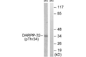 Immunohistochemistry analysis of paraffin-embedded human brain tissue using DARPP-32 (Phospho-Thr34) antibody. (DARPP32 Antikörper  (pThr34))