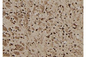 ABIN6277578 at 1/100 staining Rat brain tissue by IHC-P. (SERPINB3 Antikörper  (C-Term))