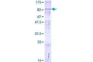 Image no. 1 for Solute Carrier Family 24 (Sodium/potassium/calcium Exchanger), Member 6 (SLC24A6) (AA 1-584) protein (GST tag) (ABIN1320237) (SLC24A6 Protein (AA 1-584) (GST tag))