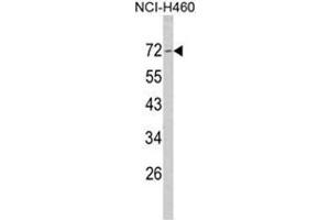 Western blot analysis of Merlin Antibody (N-term) in NCI-H460 cell line lysates (35ug/lane).