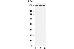 Western blot testing of BRCA1 antibody and Lane 1:  HeLa (BRCA1 Antikörper  (AA 1661-1863))