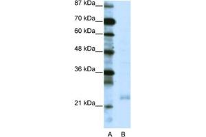 Western Blotting (WB) image for anti-TAF10 RNA Polymerase II, TATA Box Binding Protein (TBP)-Associated Factor, 30kDa (TAF10) antibody (ABIN2460218) (TAF10 Antikörper)