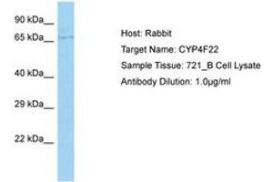 Image no. 1 for anti-Cytochrome P450, Family 4, Subfamily F, Polypeptide 22 (CYP4F22) (AA 207-256) antibody (ABIN6750174) (CYP4F22 Antikörper  (AA 207-256))