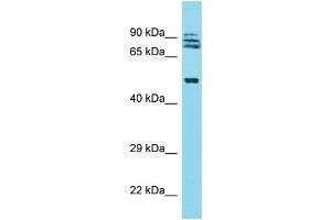 Western Blotting (WB) image for anti-Tripartite Motif Containing 64 (TRIM64) (N-Term) antibody (ABIN2500705) (TRIM64 Antikörper  (N-Term))