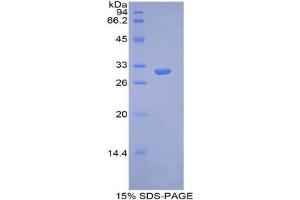 SDS-PAGE analysis of Human Glypican 4 Protein. (GPC4 Protein)