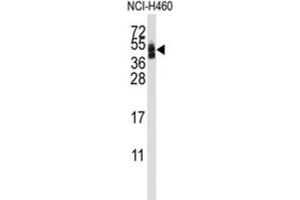 Western Blotting (WB) image for anti-Coxsackie Virus and Adenovirus Receptor (CXADR) antibody (ABIN3001668) (Coxsackie Adenovirus Receptor Antikörper)