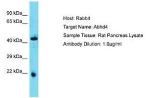 Image no. 1 for anti-Abhydrolase Domain Containing 4 (ABHD4) (AA 80-129) antibody (ABIN6750388) (ABHD4 Antikörper  (AA 80-129))