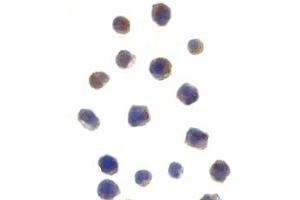 Immunohistochemistry (IHC) image for anti-Checkpoint Kinase 2 (CHEK2) (N-Term) antibody (ABIN1031318) (CHEK2 Antikörper  (N-Term))