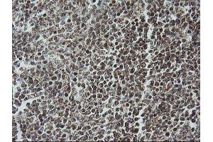 Image no. 3 for anti-NADH Dehydrogenase (Ubiquinone) 1 beta Subcomplex, 10, 22kDa (NDUFB10) antibody (ABIN1499669)