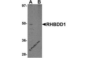Western Blotting (WB) image for anti-Rhomboid Domain Containing 1 (RHBDD1) (C-Term) antibody (ABIN1030618) (RHBDD1 Antikörper  (C-Term))