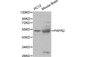 Western blot analysis of various cell lines, using PARK2 antibody. (Parkin Antikörper)