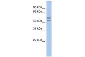 Image no. 1 for anti-Solute Carrier Family 37 (Glucose-6-Phosphate Transporter), Member 4 (SLC37A4) (AA 179-228) antibody (ABIN6743205)